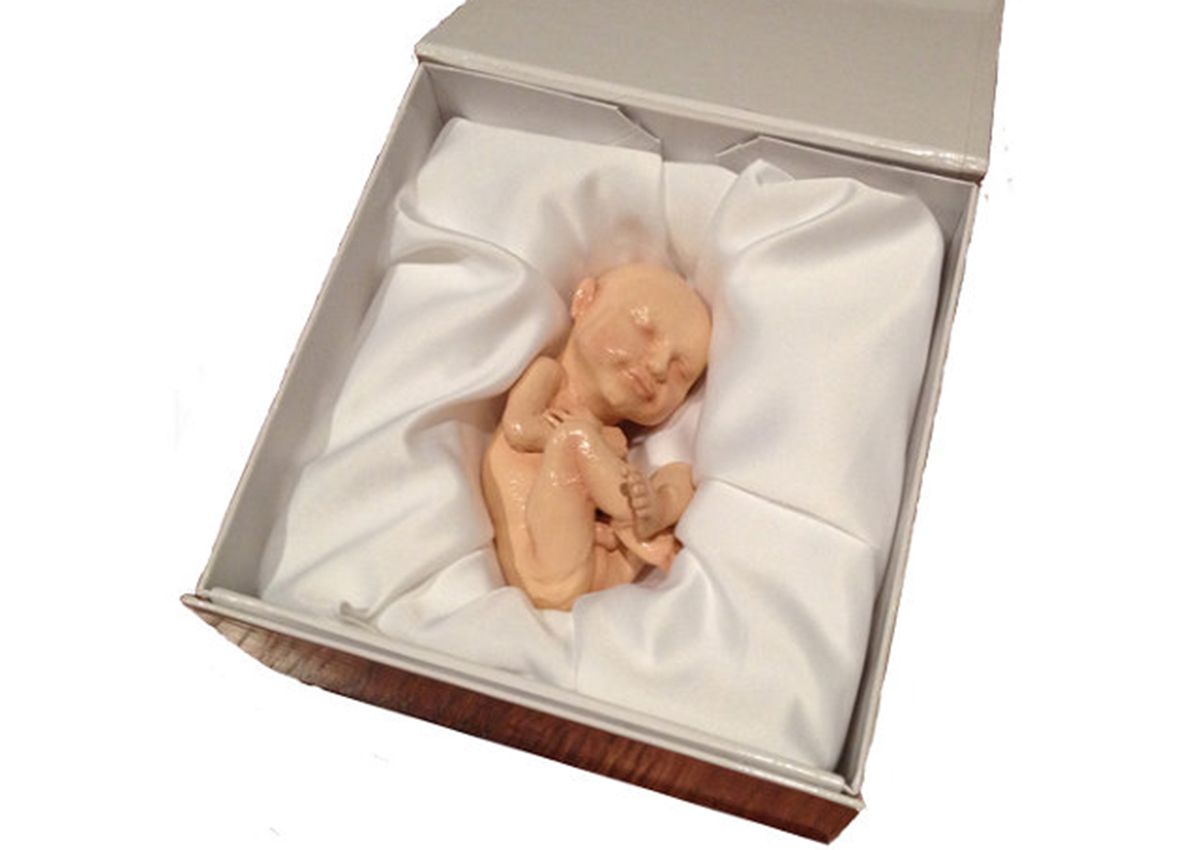 3d print your unborn fetus in a creepy new use for 4d ultrasound scans image 1