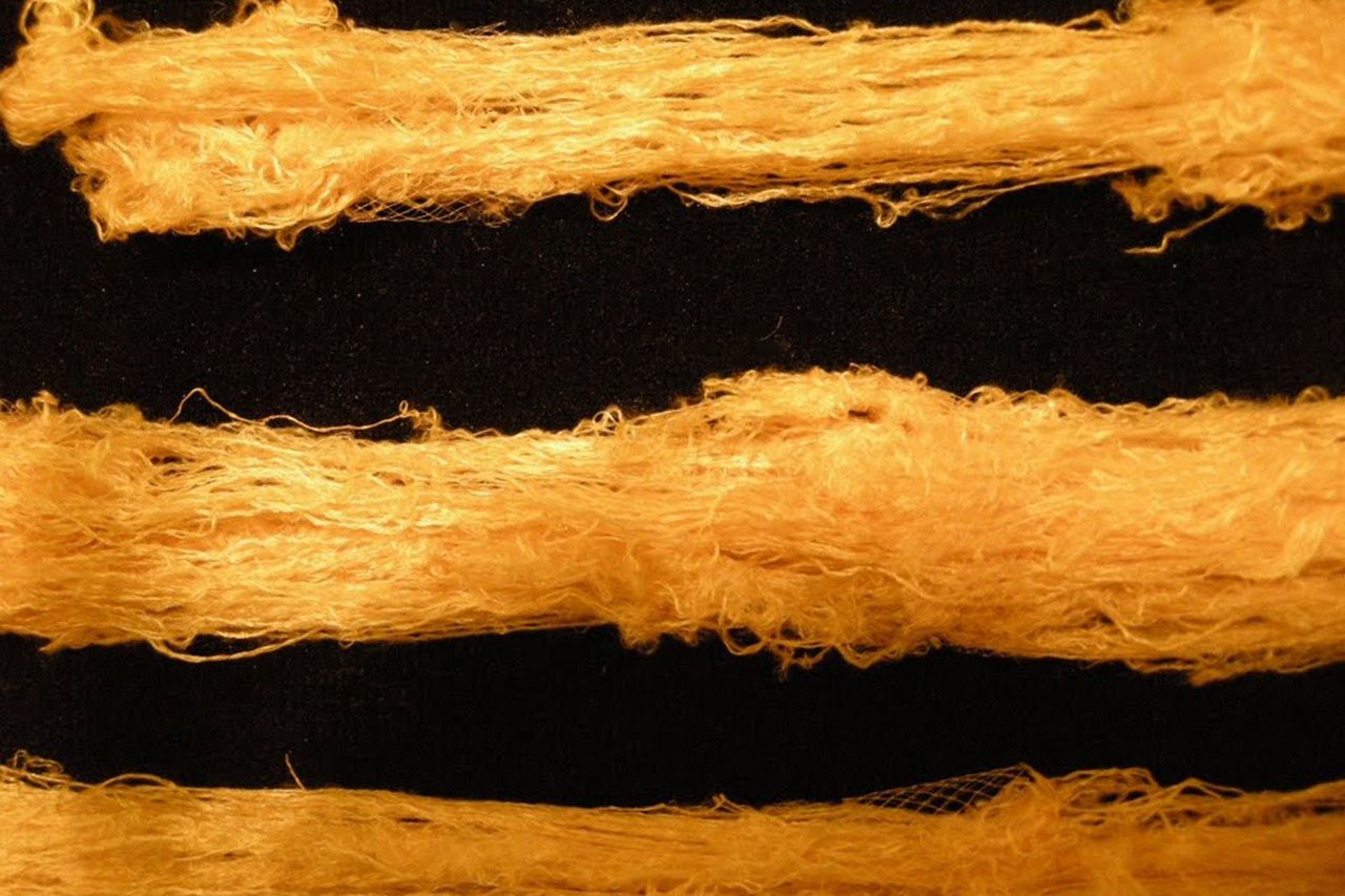 spider silk could offer bullet proof skin grafts by 2015 image 1