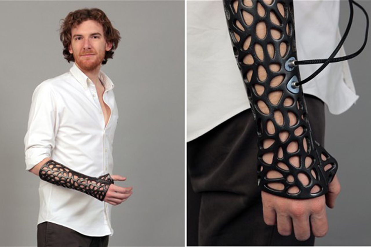 3d printed osteoid cast could heal broken bones 40 per cent faster image 1