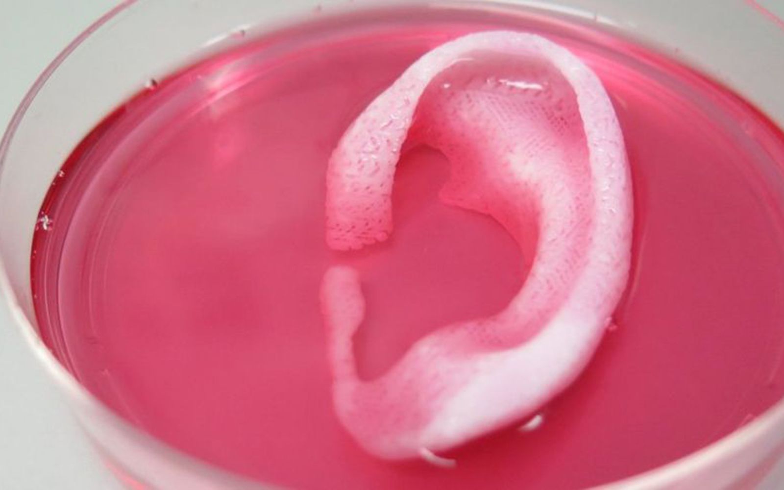 3d printed body parts are here jaw dropping print a new one image 1
