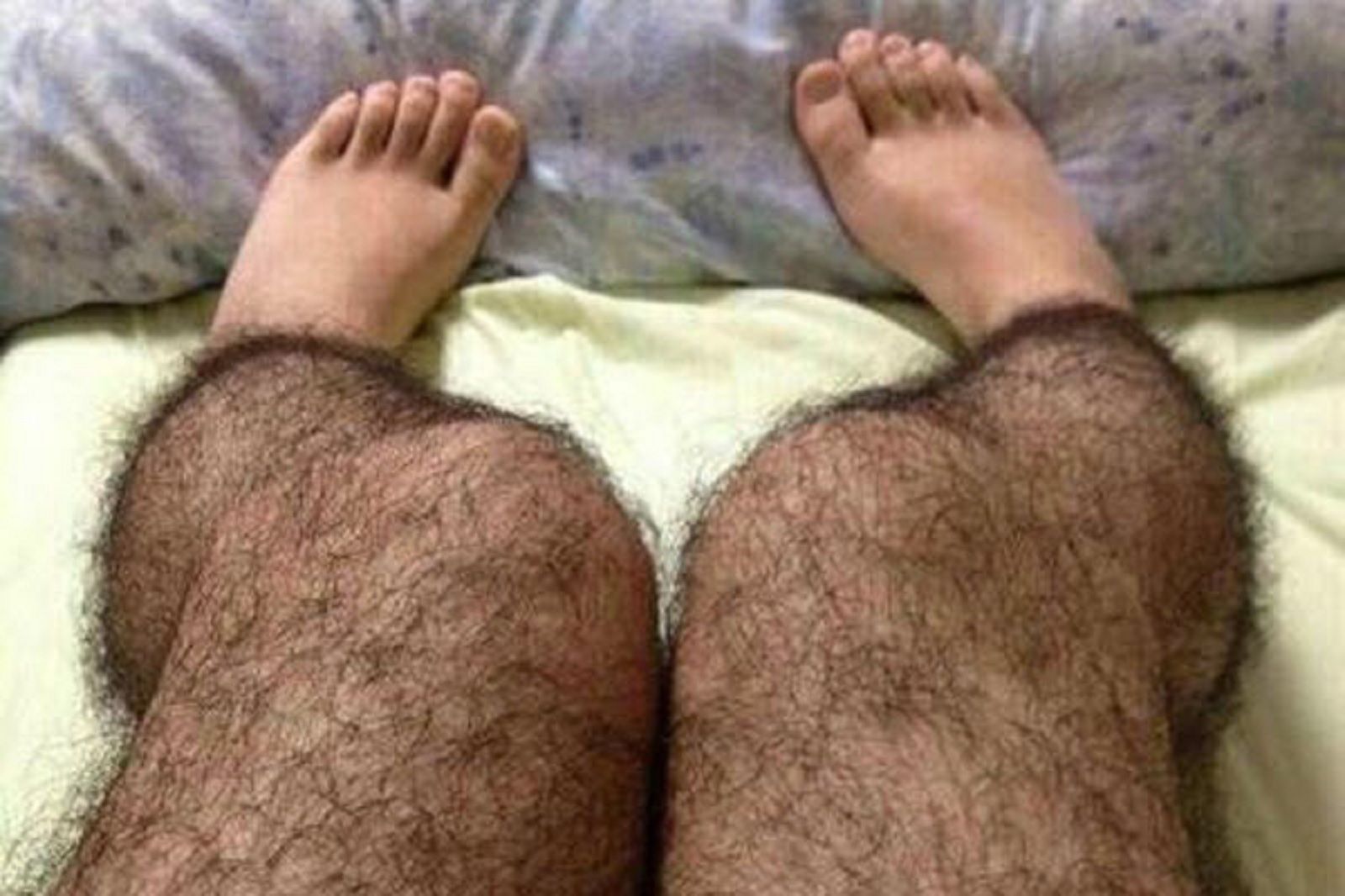 Hairy 1. Женская Волосатость на ногах. Фото очень волосатых женщин.