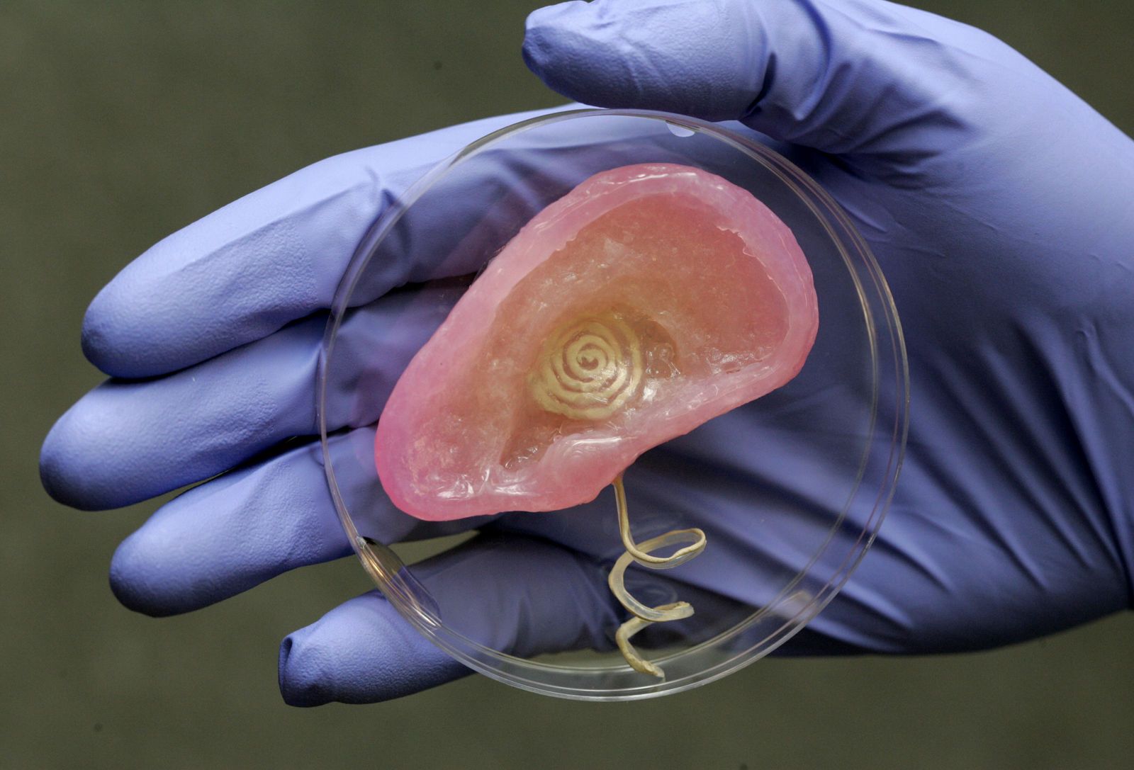 Medical marvels How 3D printing is improving our lives image 14
