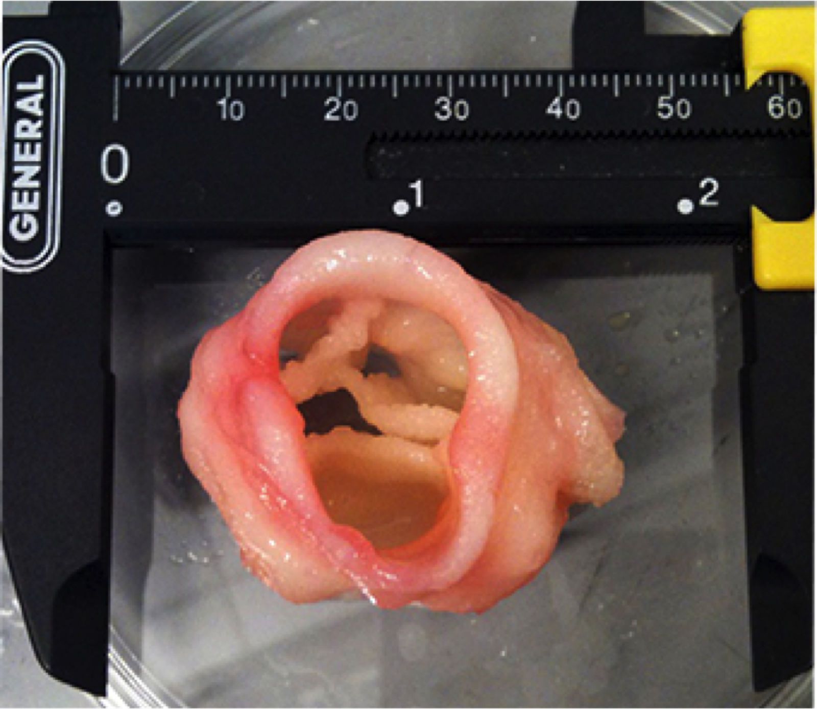 Medical marvels How 3D printing is improving our lives image 8