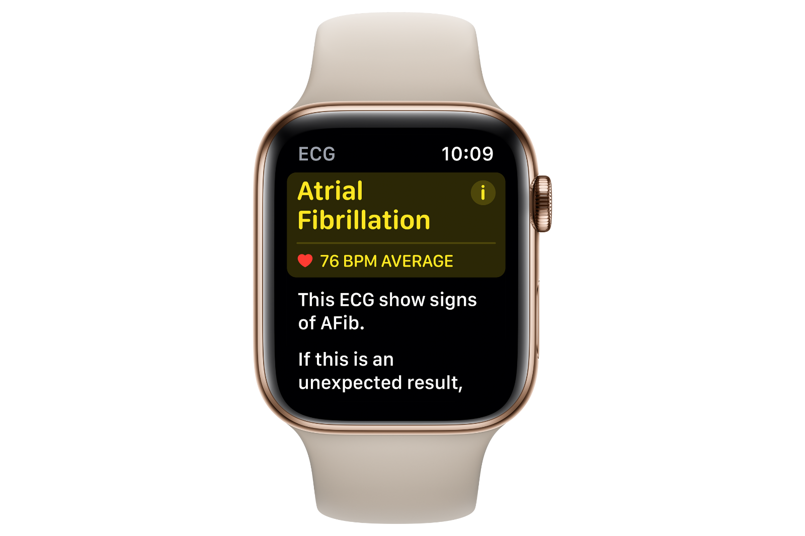 what-is-apple-watch-ecg-and-how-do-you-set-it-up