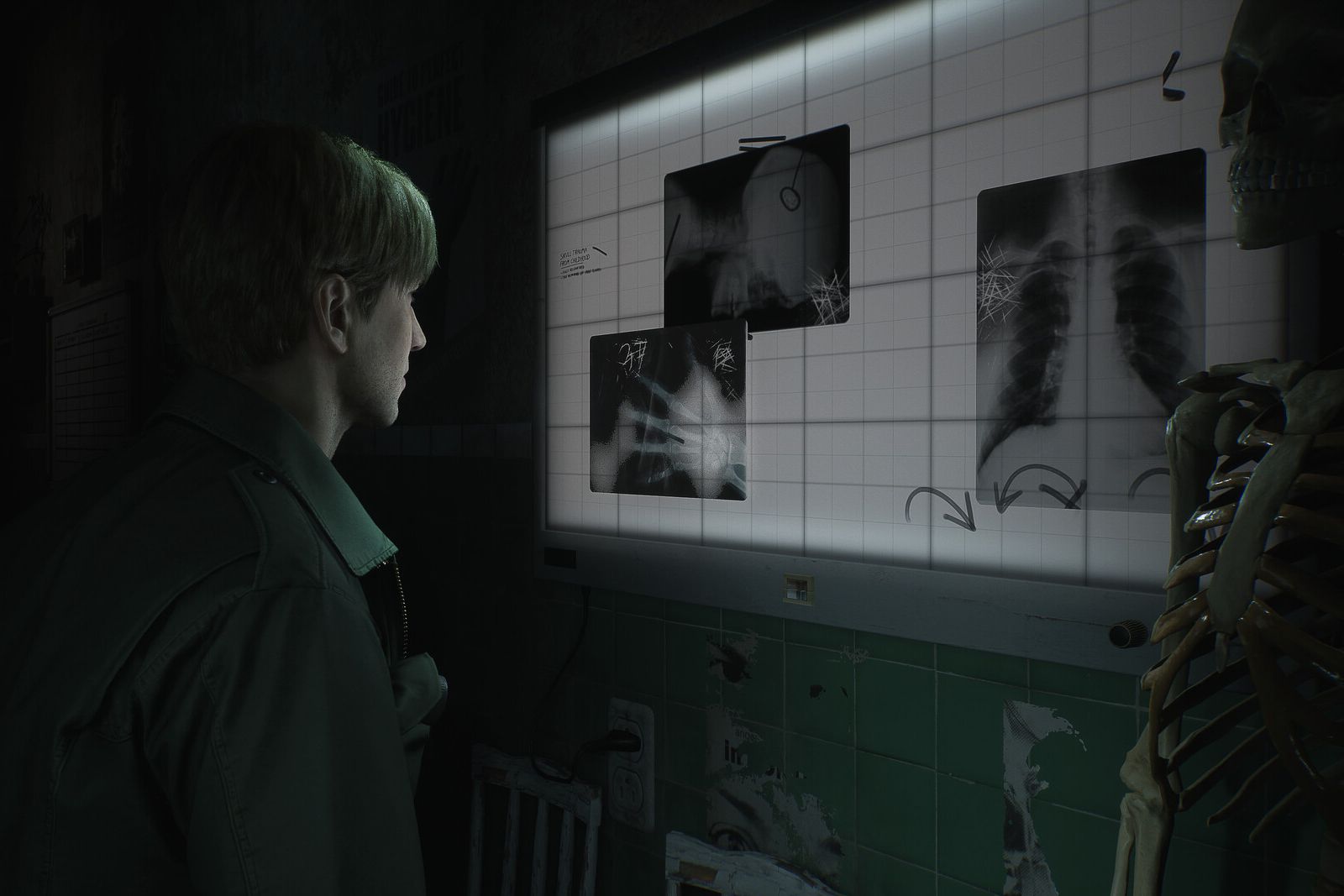 Everything we know about the Silent Hill 2 remake: Trailer, story and more photo 2