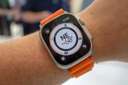 How To Stop Rashes When Wearing An Apple Watch