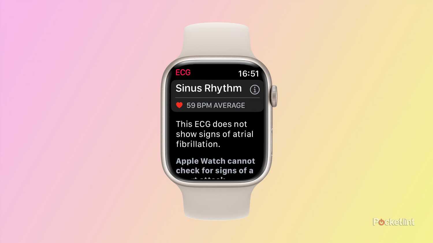 App Ecg Test Watch App Apple Watch Series Ecg Test How To Set Up